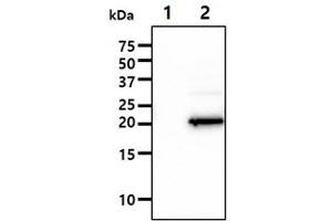 The Cell lysates (10ug) were resolved by SDS-PAGE, transferred to PVDF membrane and probed with anti-human IMP3 antibody (1:1000). (IMP3 抗体)