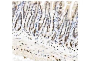 IHC analysis of HP1 alpha/CBX5 using anti-HP1 alpha/CBX5 antibody (ABIN7599058).