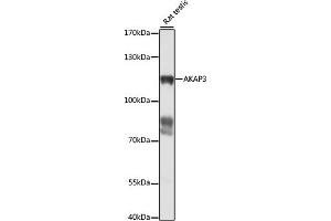 Western blot analysis of extracts of rat testis, using  antibody (ABIN7265352) at 1:1000 dilution. (AKAP3 抗体  (AA 1-300))