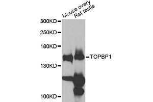 Western blot analysis of extracts of various cell lines, using TOPBP1 antibody (ABIN6291479) at 1:1000 dilution. (TOPBP1 抗体)
