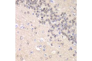 Immunohistochemistry of paraffin-embedded rat brain using CCNC antibody at dilution of 1:100 (x40 lens). (Cyclin C 抗体)