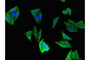 Immunofluorescent analysis of HepG2 cells using ABIN7147455 at dilution of 1:100 and Alexa Fluor 488-congugated AffiniPure Goat Anti-Rabbit IgG(H+L) (CERK 抗体  (AA 212-478))