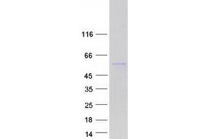 Western Blotting (WB) image for Pleckstrin and Sec7 Domain Containing 3 (PSD3) (Transcript Variant 2) protein (Myc-DYKDDDDK Tag) (ABIN2729872)
