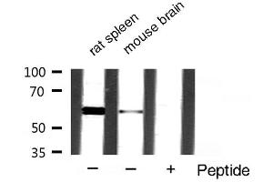 Western blot analysis of extracts of various samples,using akt2 antibody. (AKT2 抗体  (C-Term))