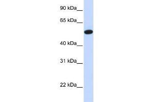 WB Suggested Anti-CEACAM16 Antibody Titration:  0.