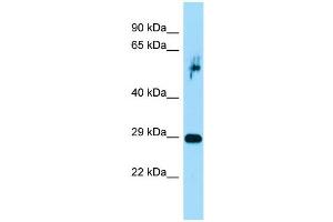 Host:  Rabbit  Target Name:  Prrx1  Sample Type:  Rat Pancreas lysates  Antibody Dilution:  1. (PRRX1 抗体  (C-Term))