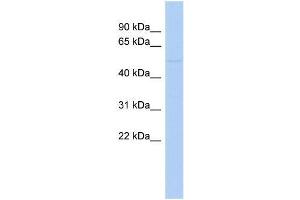 Human COLO205; WB Suggested Anti-ZNF669 Antibody Titration: 0. (ZNF669 抗体  (N-Term))