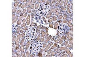 IHC analysis of p57 Kip2/CDKN1C using anti-p57 Kip2/CDKN1C antibody (ABIN7603232). (CDKN1C 抗体  (N-Term))