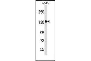 Western blot analysis of SCC-112 / PDS5A Antibody (C-term) in A549 cell line lysates (35ug/lane). (PDS5A 抗体  (C-Term))