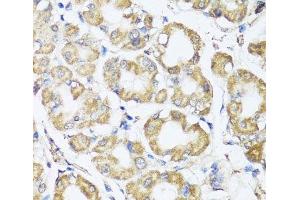 Immunohistochemistry of paraffin-embedded Human stomach using B9D1 Polyclonal Antibody at dilution of 1:100 (40x lens). (B9D1 抗体)