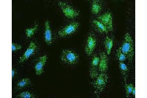IF analysis of MMP1 using anti-MMP1 antibody (ABIN7599873). (MMP1 抗体  (AA 124-469))