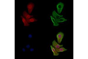 Phospho-p53 (Ser33) Antibody staining Hela cells(heat shock treatment) by IF/ICC. (p53 抗体  (pSer33))
