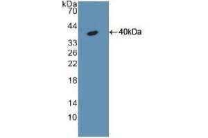 Western blot analysis of recombinant Rat KRT18. (Cytokeratin 18 抗体  (AA 72-380))