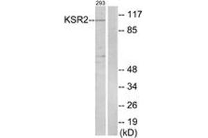 Western blot analysis of extracts from 293 cells, using KSR2 Antibody. (KSR2 抗体  (AA 671-720))