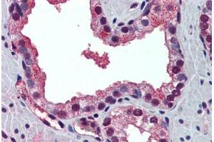 Human Prostate: Formalin-Fixed, Paraffin-Embedded (FFPE) (PABPN1 抗体  (N-Term))