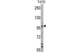 Western Blotting (WB) image for anti-Ubiquitin Protein Ligase E3A (ube3a) antibody (ABIN3001484) (ube3a 抗体)