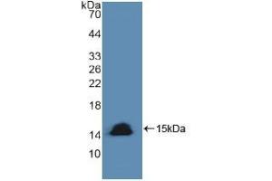 Western blot analysis of recombinant Human CASP8. (Caspase 8 抗体  (AA 385-479))