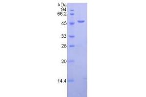 SDS-PAGE analysis of Human LAMP2 Protein. (LAMP2 蛋白)