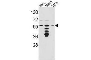 Image no. 1 for anti-FK506 Binding Protein 4, 59kDa (FKBP4) (Middle Region) antibody (ABIN453015) (FKBP4 抗体  (Middle Region))