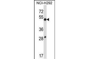 Western blot analysis in NCI-H292 cell line lysates (35ug/lane). (DUSP9 抗体  (C-Term))