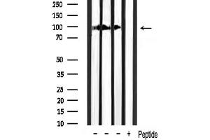 Western blot analysis of lysates from mouse muscle/rat spleen/mouse brain, using Phospho-Catenin beta (Ser37) Antibody.