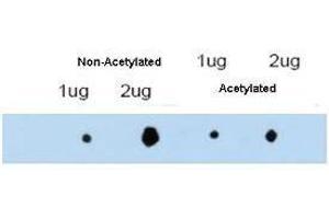 affinity purified anti-ATDC antibody shows reactivity by dot blot with acetylated and non-acetylated forms of the immunizing peptide. (TRIM29 抗体  (Internal Region))