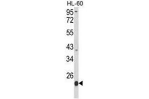 Western blot analysis of PSMB9 Antibody (C-term) in HL-60 cell line lysates (35ug/lane). (PSMB9 抗体  (C-Term))