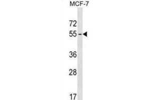 Western Blotting (WB) image for anti-Melanoma Antigen Family B, 18 (MAGEB18) antibody (ABIN3000090) (MAGEB18 抗体)