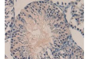 Detection of OCM in Mouse Testis Tissue using Polyclonal Antibody to Oncomodulin (OCM) (Oncomodulin 抗体  (AA 1-109))