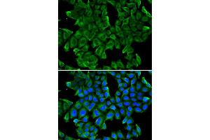 Immunofluorescence analysis of MCF-7 cell using REG3G antibody. (REG3g 抗体)
