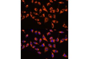 Immunofluorescence (IF) image for anti-Guanine Nucleotide Binding Protein (G Protein), beta Polypeptide 2 (GNB2) (AA 1-340) antibody (ABIN6141223)