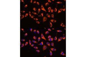 Immunofluorescence analysis of L929 cells using GNB2 Rabbit pAb  at dilution of 1:100 (40x lens). (GNB2 抗体  (AA 1-340))