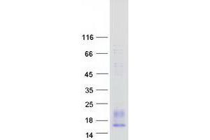 Western Blotting (WB) image for Platelet Factor 4 Variant 1 (PF4V1) protein (Myc-DYKDDDDK Tag) (ABIN2728720)