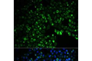 Immunofluorescence analysis of HeLa cells using UGDH Polyclonal Antibody (UGDH 抗体)