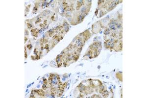 Immunohistochemistry of paraffin-embedded human stomach using MGP antibody at dilution of 1:100 (40x lens). (MGP 抗体)