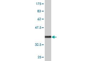Western Blot detection against Immunogen (36. (DPYSL5 抗体  (AA 466-564))