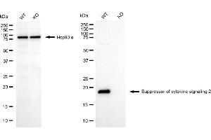 Western blotting analysis using suppressor of cytokine signaling 2 antibody (ABIN7800465). (Recombinant SOCS2 抗体)