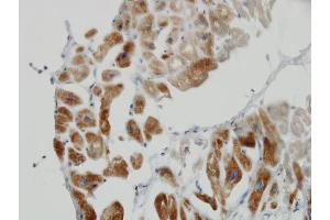 Immunoperoxidase of monoclonal antibody to DLD on formalin-fixed paraffin-embedded human heart.