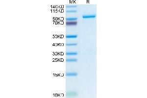Periostin Protein (POSTN) (AA 22-836) (His tag)