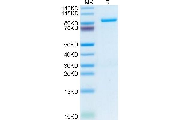 Periostin Protein (POSTN) (AA 22-836) (His tag)