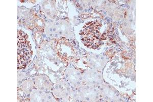 Immunohistochemistry of paraffin-embedded Rat kidney using CD34 Polyclonal Antibody at dilution of 1:100 (40x lens). (CD34 抗体)