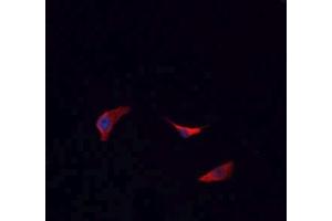 ABIN6266693 staining HeLa cells by IF/ICC. (BCKDK 抗体  (N-Term))