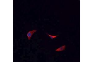 ABIN6266693 staining HeLa cells by IF/ICC.