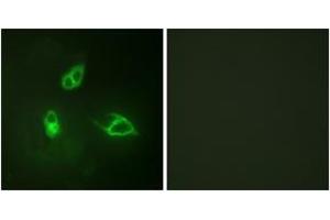 Immunofluorescence analysis of HepG2 cells, using IL-8R beta/CDw128 beta (Ab-347) Antibody. (CXCR2 抗体  (AA 311-360))