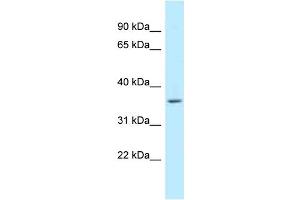 WB Suggested Anti-WBSCR22 Antibody Titration: 1.