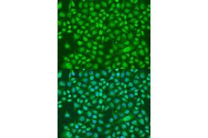 Immunofluorescence analysis of U2OS cells using KDM7A antibody (ABIN6293223) at dilution of 1:100. (JHDM1D 抗体)