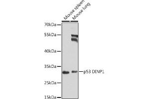 Western blot analysis of extracts of various cell lines, using p53 DINP1 antibody (ABIN6133846, ABIN6149422, ABIN6149423 and ABIN6224287) at 1:1000 dilution. (TP53INP1 抗体  (AA 1-100))