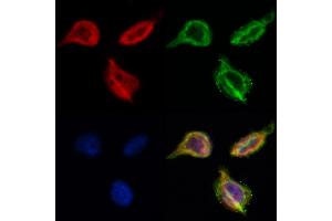 ABIN6261208 and ABIN6268648 staining Hela by IF/ICC.