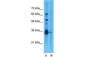 Host:  Rabbit  Target Name:  GAPDH  Sample Type:  293T  Lane A:  Primary Antibody  Lane B:  Primary Antibody + Blocking Peptide  Primary Antibody Concentration:  1ug/ml  Peptide Concentration:  5ug/ml  Lysate Quantity:  25ug/lane/lane  Gel Concentration:  0. (GAPDH 抗体  (N-Term))