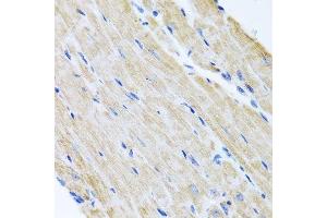 Immunohistochemistry (Paraffin-embedded Sections) (IHC (p)) image for anti-ATP-Binding Cassette, Sub-Family B (MDR/TAP), Member 8 (ABCB8) (AA 469-718) antibody (ABIN3016383)